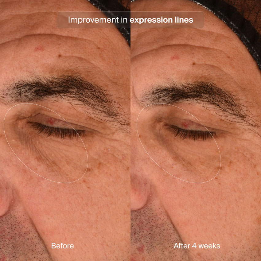 Pavise Precision Eye Lift (15mL) - Image 7