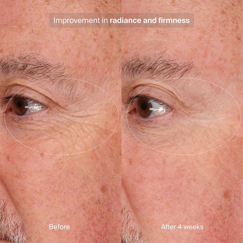 Pavise Precision Eye Lift (15mL) - Image 5