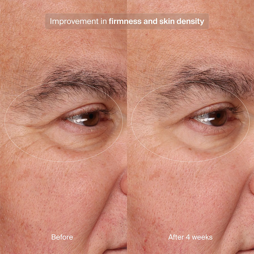 Pavise Precision Eye Lift (15mL) - Image 6