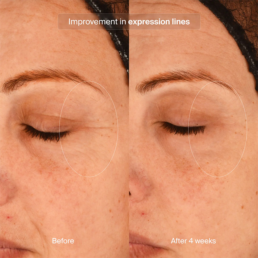 Pavise Precision Eye Lift (15mL) - Image 8