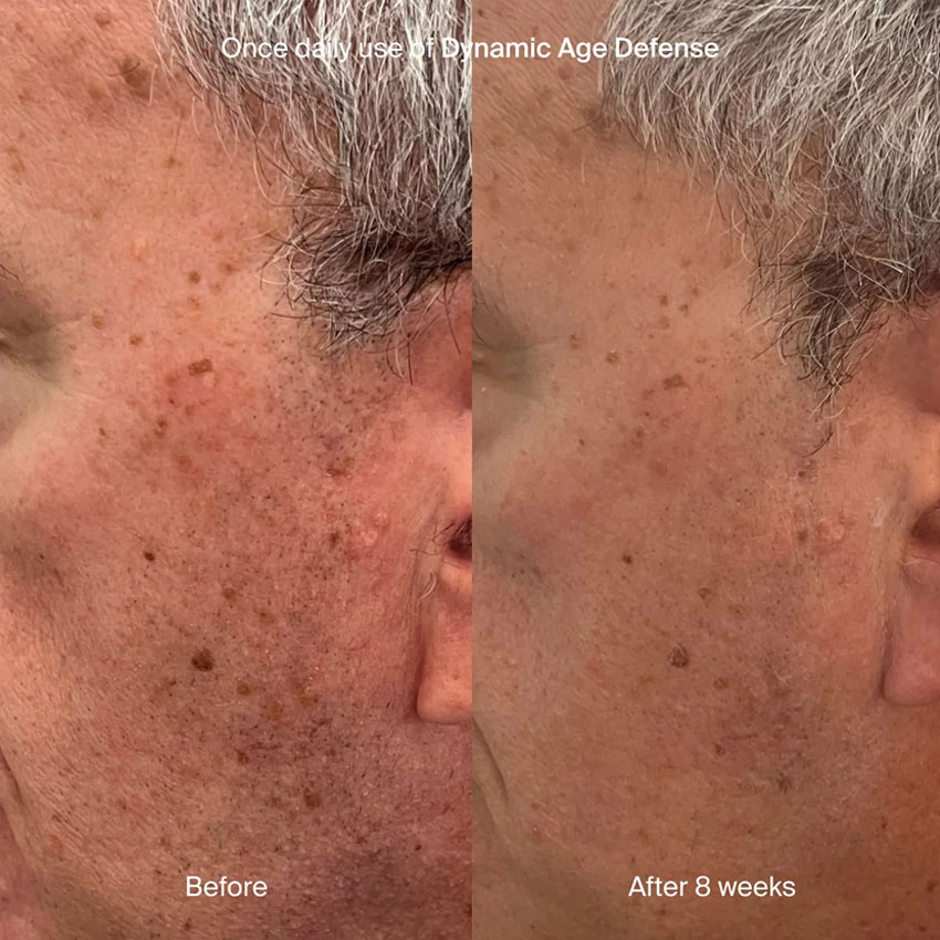 Pavise Dynamic Age Defense (30mL) - Image 7